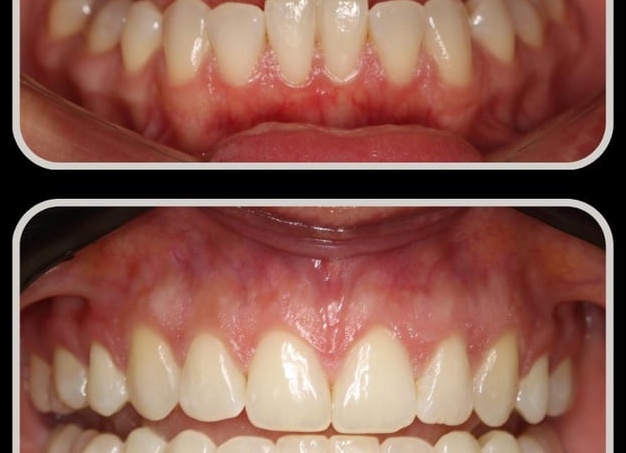 Улыбка картинка - фото и изображения, которые поднимут настроение Улыбка картинка - фото и изображения, которые поднимут настроение